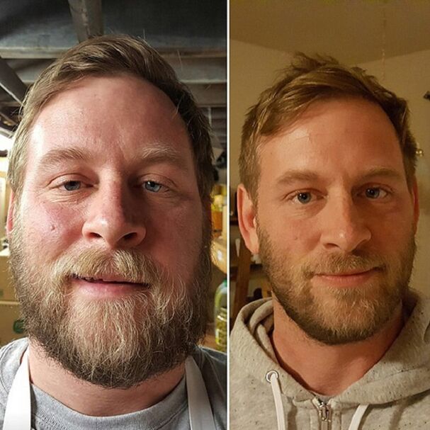 a aparición da persoa antes e despois de renunciar ao alcol
