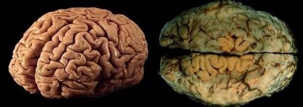 o cerebro dunha persoa sa e potable